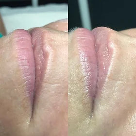 Beautiful Lips Box Before and After