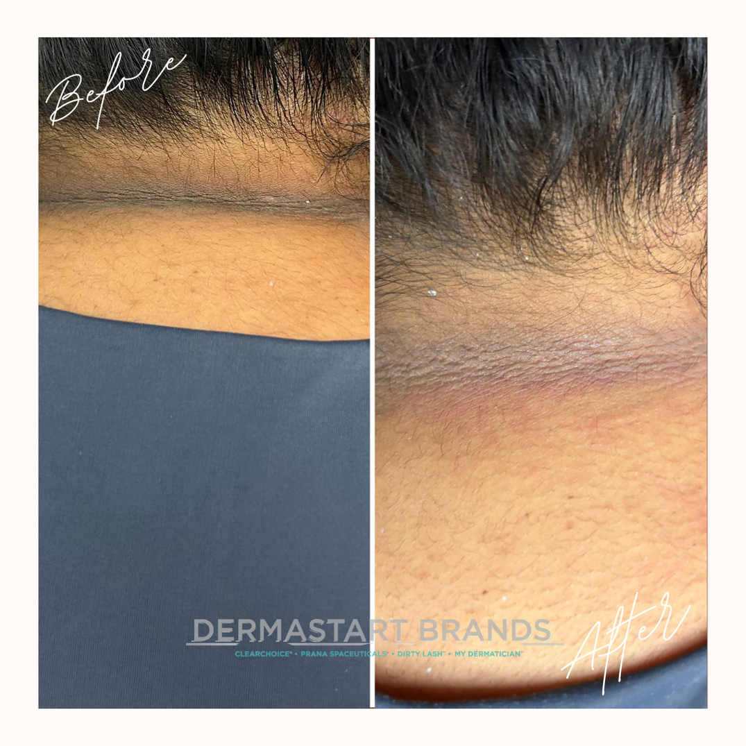 Protocols Dermastart Brands